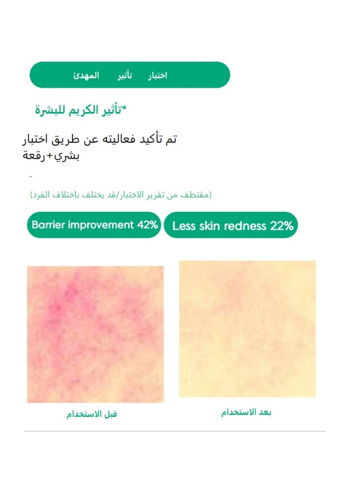 DEOPROCE Cica Repair Skin Repair Cream 100ml - Image 2